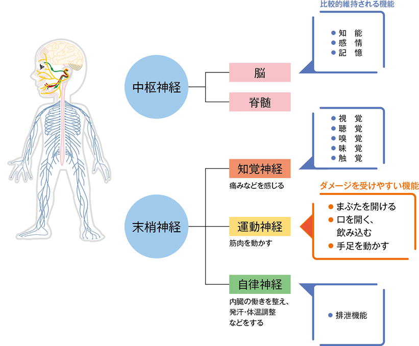 四肢発症型ALSとは何ですか？